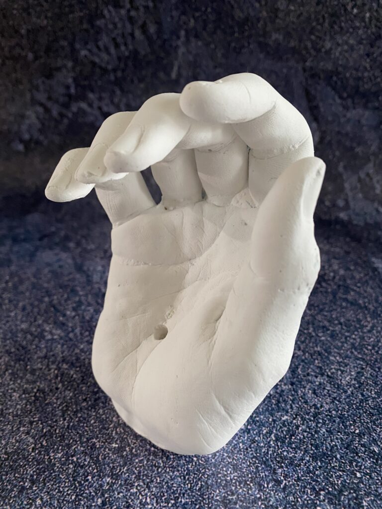 Une main moulée en plâtre dans un gant jetable